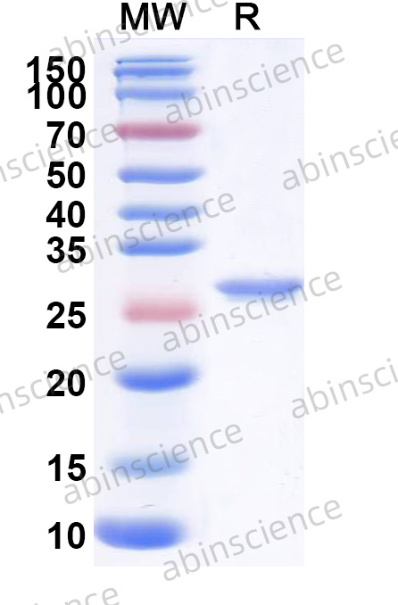 GST/Glutathione S-transferase Recombinant Protein (C-His)