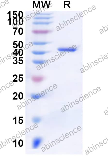 Isocitrate lyase Recombinant Protein (N-His)