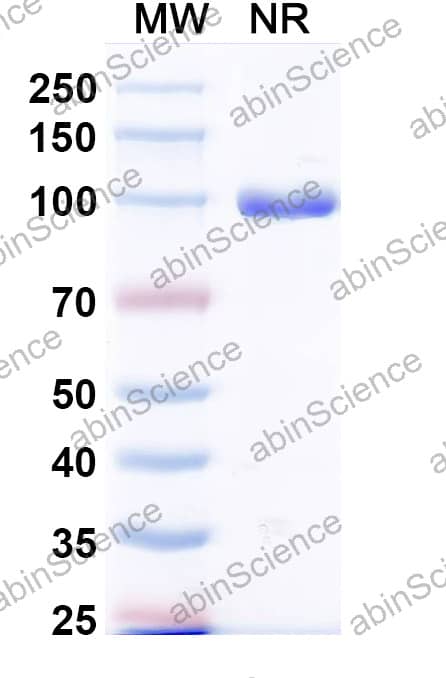 Anti-Mycobacterium tuberculosis icl1/Isocitrate lyase 1 Recombinant Antibody (SAA2568)