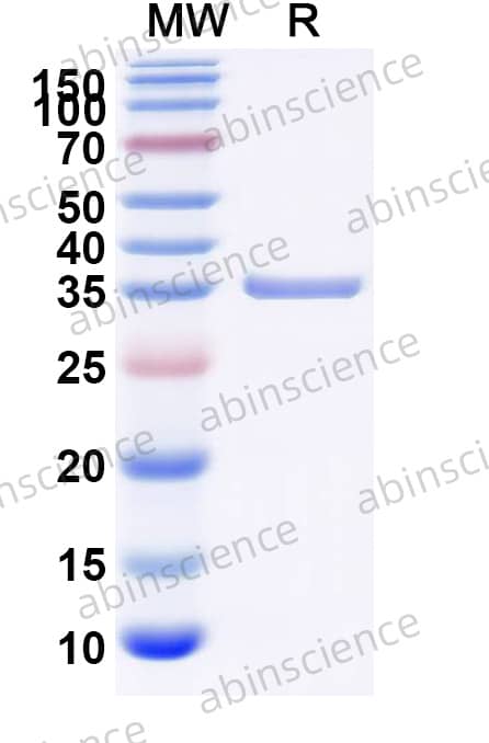 Strep tag Control (C-terminal) Recombinant Protein
