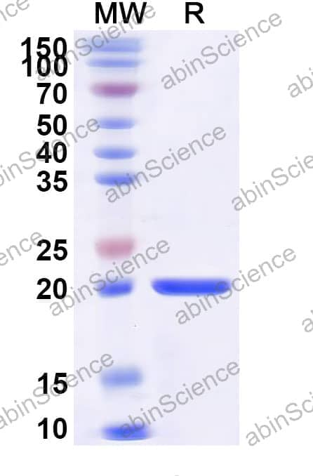 Mouse SMC4 Recombinant Protein (N-His)