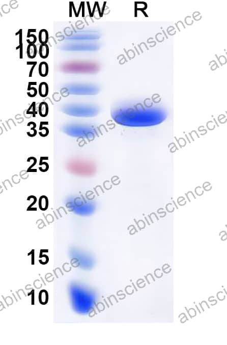 Mouse CHIL3 Recombinant Protein (C-His)