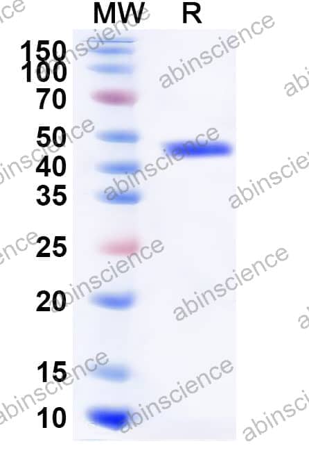 Mouse CHIL3 Recombinant Protein (N-His)