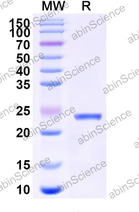 Mouse PMVK Recombinant Protein (N-His)