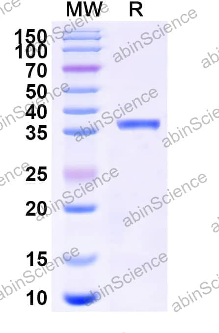 Mouse RETNLA/FIZZ1 Recombinant Protein (N-GST & C-His)