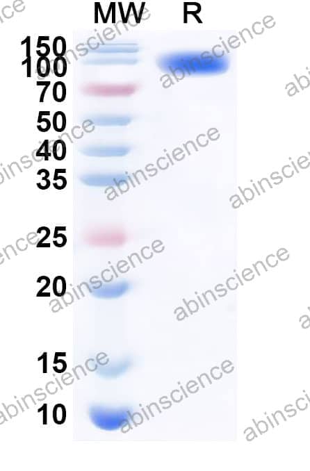 Mouse SEMA4A Recombinant Protein (C-Fc)