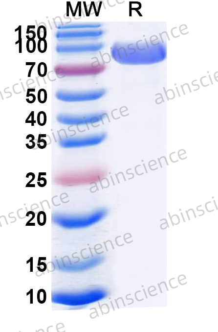 Mouse CD31/PECAM1 Recombinant Protein (C-His)