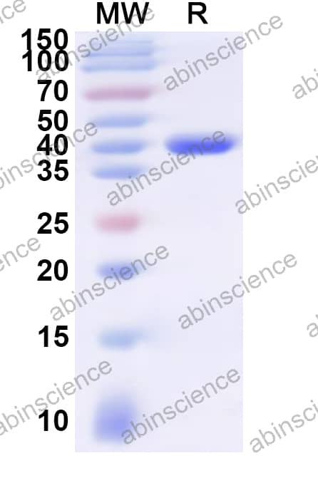 Mouse FPR1 Recombinant Protein (N-GST & C-His)
