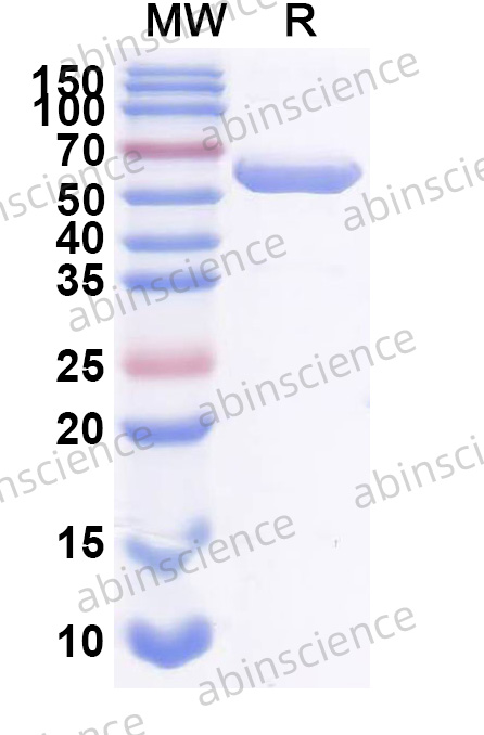 Mouse DSP Recombinant Protein (N-His)