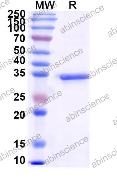 Mouse ITGA3/CD49c Recombinant Protein (N-His)