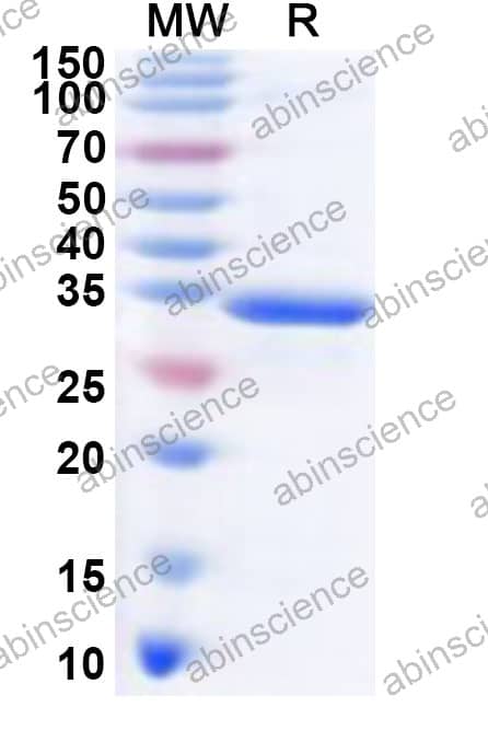 Mouse S100A1 Recombinant Protein (N-GST & C-His)