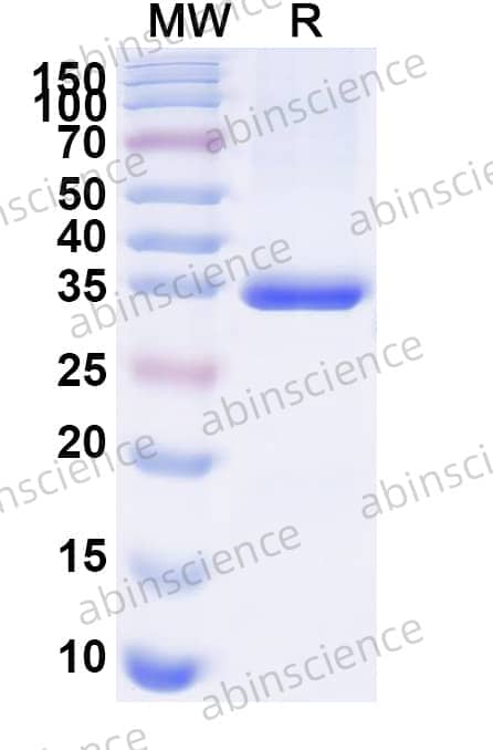 Mouse DRD1 Recombinant Protein (N-His-KSI)