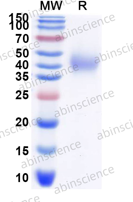 Mouse CD44 Recombinant Protein (C-His)