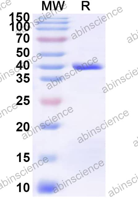 Mouse OXTR Recombinant Protein (N-GST & C-His)