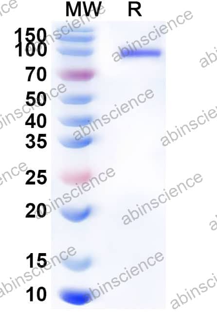 Recombinant Mouse FLT1 Protein, C-His