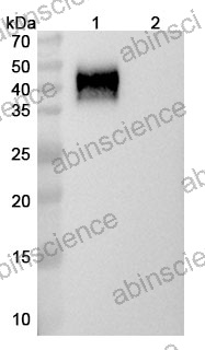 InVivoMAb Anti-Mouse CTLA-4&PD-L1/B7-H1 Antibody (Iv0226)