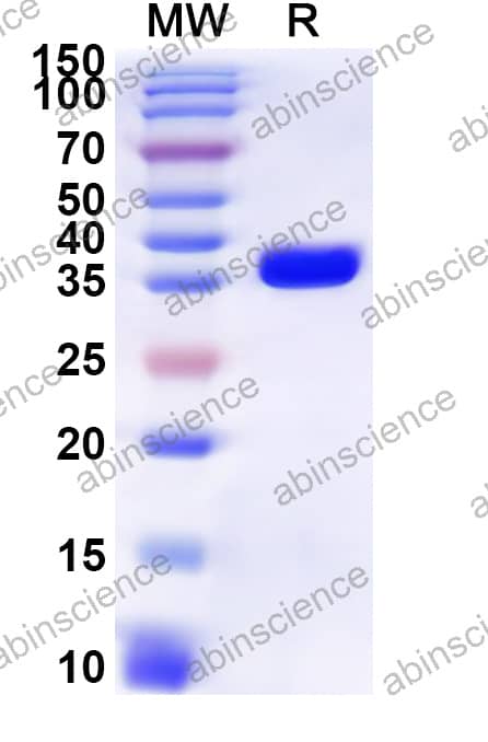 Mouse CD179b/IGLL1 Recombinant Protein (N-GST & C-His)