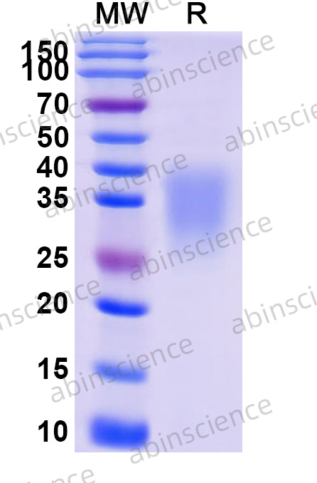Mouse OSM/Oncostatin-M Recombinant Protein (C-His)