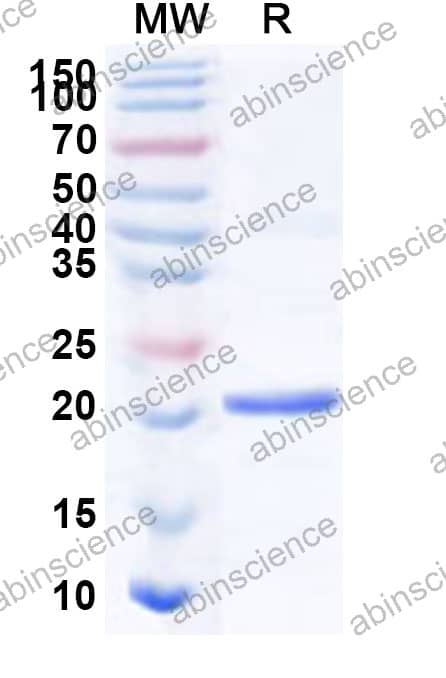 Recombinant Mouse TM4SF1 Protein, N-His-KSI