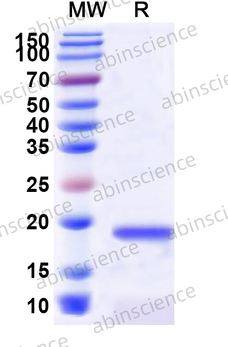 Mouse IL9 Recombinant Protein (N-His)