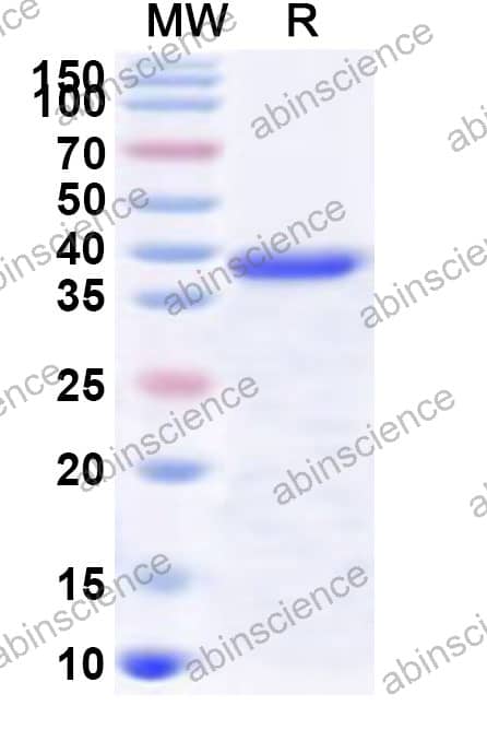 Mouse CD121a/IL1R1 Recombinant Protein (N-His)