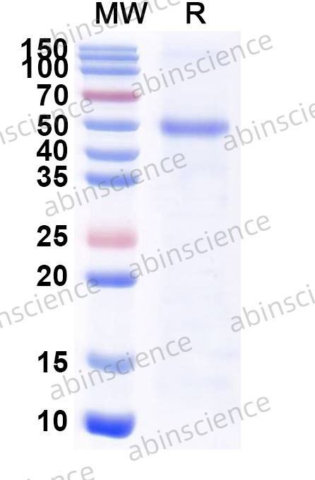 Mouse CFP Recombinant Protein (N-His)