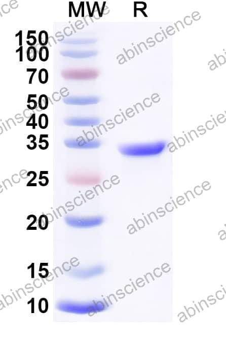 Mouse CD27 Ligand/TNFSF7/CD70 Recombinant Protein (C-Fc)