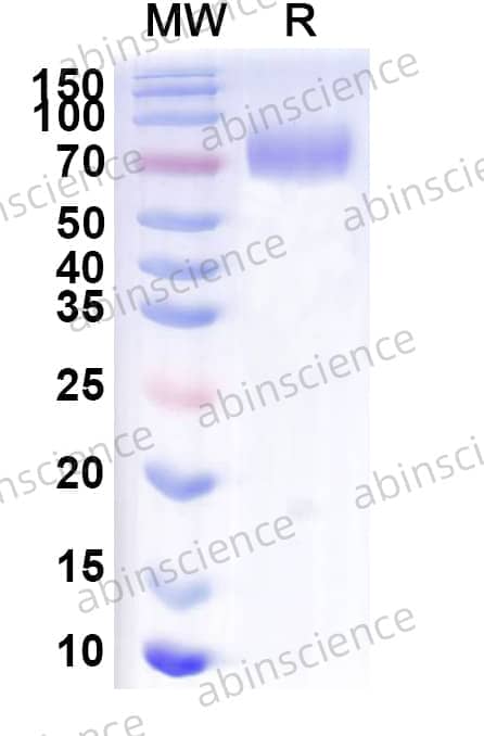 Mouse CD6 Recombinant Protein (C-Fc)