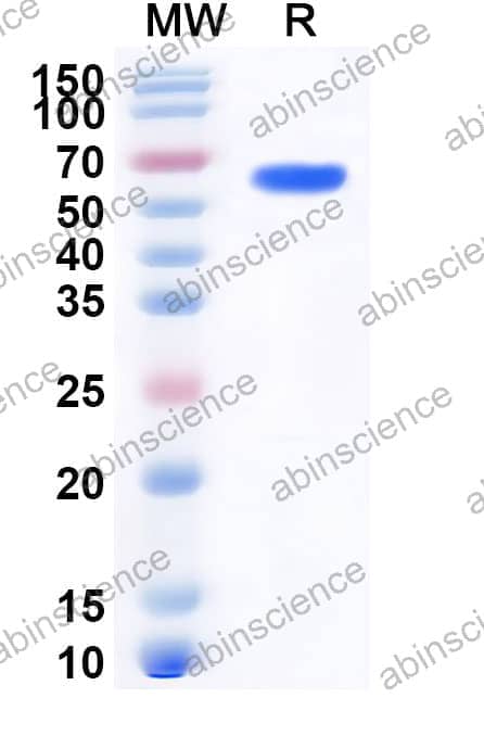 Mouse Prolactin R Recombinant Protein (C-Fc)