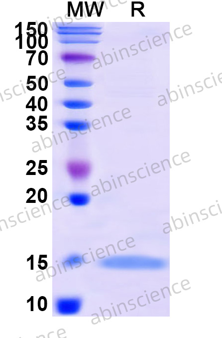 Mouse ZFP36 Recombinant Protein (N-His)