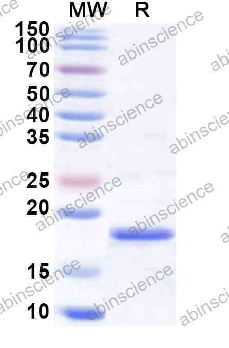 Mouse ME2 Recombinant Protein (N-His)