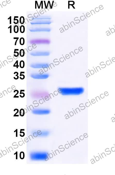 Mouse N-Cadherin Recombinant Protein (N-His)