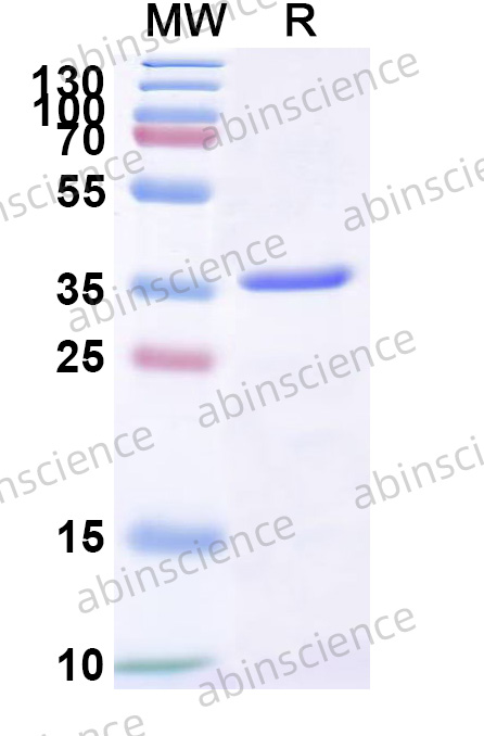 Mouse IGFBP2 Recombinant Protein (C-His)