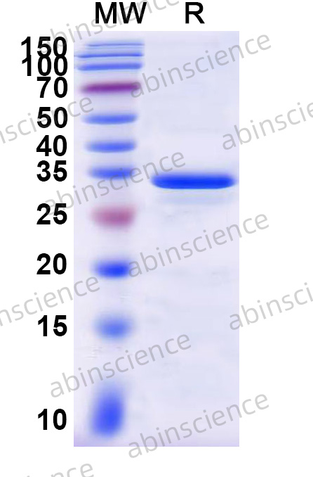 Mouse CXCL2 Recombinant Protein (N-GST&C-His)
