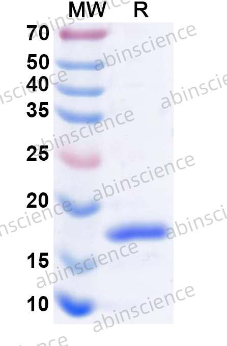 Mouse MDK/Midkine Recombinant Protein (N-His)