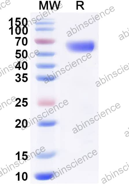 Mouse CD119/IFNGR1 Recombinant Protein (C-Fc)