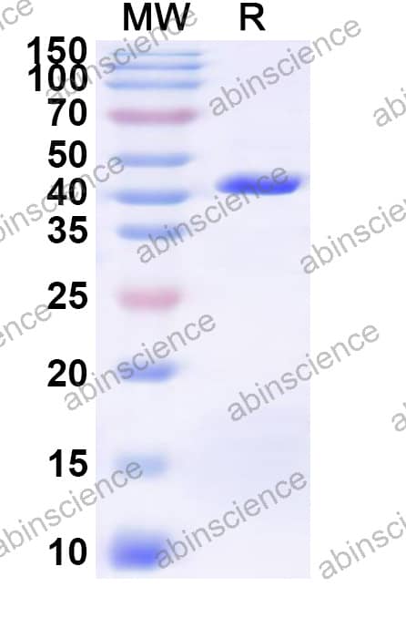 Mouse GNRHR Recombinant Protein (N-GST & C-His)