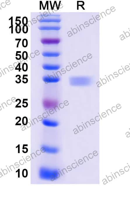 Mouse EFNA2 Recombinant Protein (C-His)