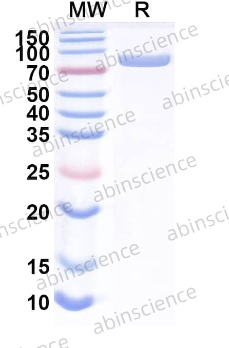 Mouse TF/Serotransferrin Recombinant Protein (C-His)