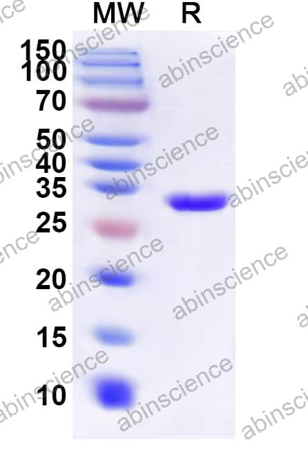 Mouse SLC35A1 Recombinant Protein (N-His-KSI)
