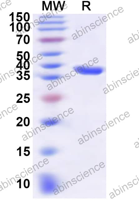 Mouse LHFPL5 Recombinant Protein (N-GST & C-His)