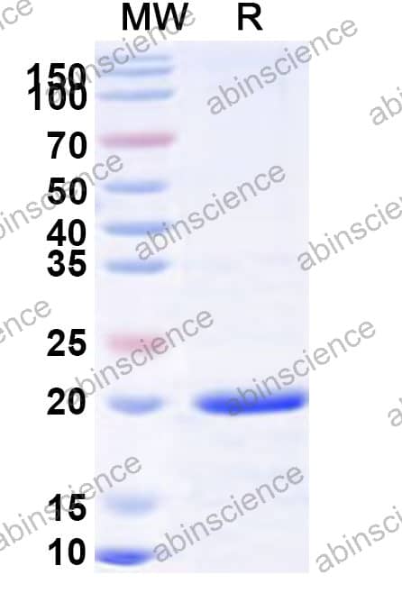 Mouse POPDC2 Recombinant Protein (N-His)