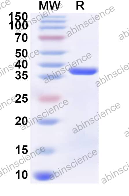 Mouse HNRNPLL Recombinant Protein (N-GST & C-His)