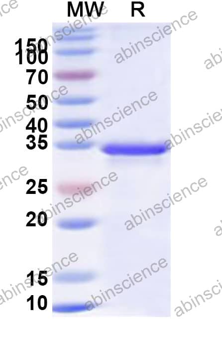 Mouse NFIA Recombinant Protein (N-His)