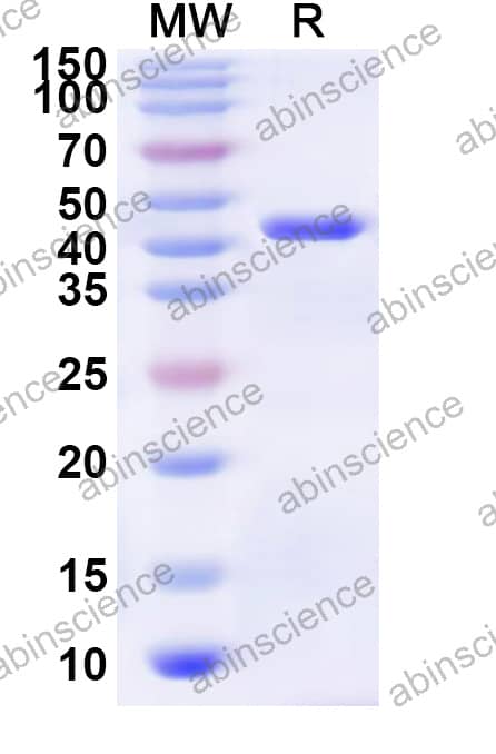 Mouse SERPINI1 Recombinant Protein (N-His)