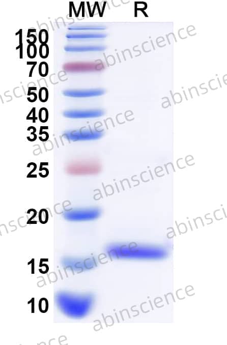 Mouse NEXN/Nexilin Recombinant Protein (N-His)