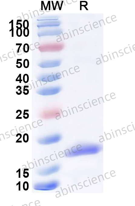 Mouse CD69 Recombinant Protein (N-His)