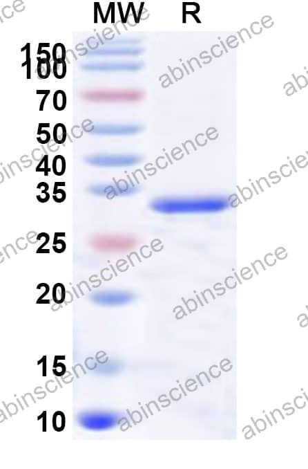 Mouse TFF3 Recombinant Protein (N-GST & C-His)