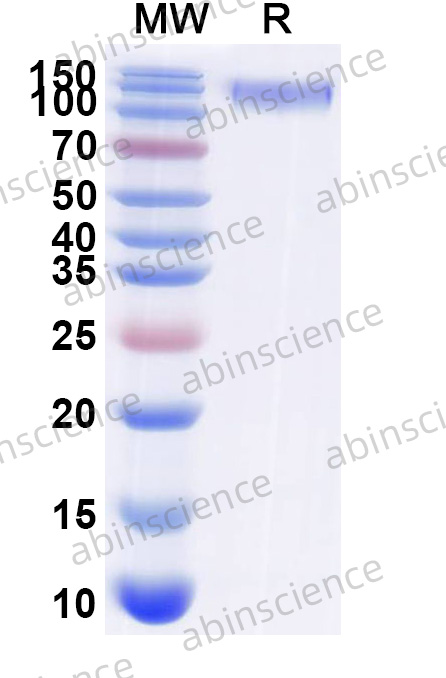 Mouse MERTK Recombinant Protein (C-Fc)