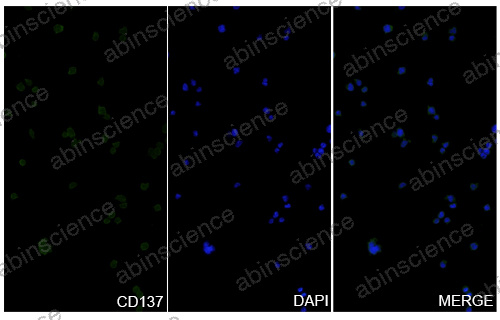 Anti-Mouse 4-1BB/TNFRSF9/CD137 Recombinant Antibody (LOB12.3)